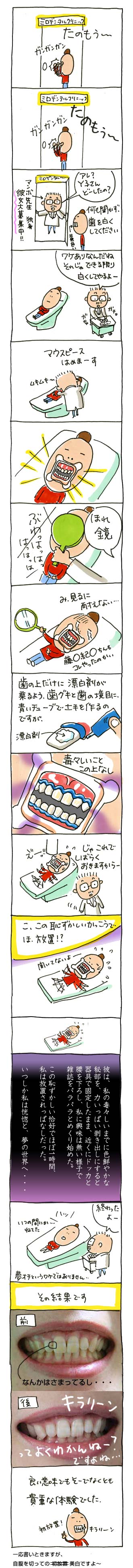 歯を美白